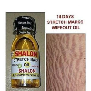 Shalom Stretch Mark Oil